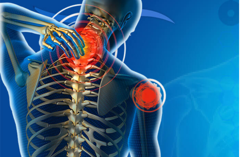 Spine Disorders